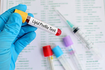 Pictured is an image of a lipid profile test.